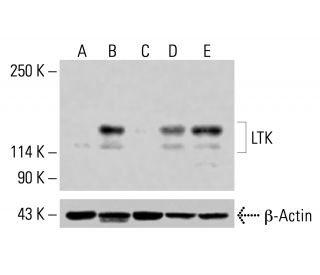 LTK Antibody (B-6) - Western Blotting - Image 415251Each CRISPR/Cas9 Knockout (KO) Plasmid product consists of a pool of 3 plasmids designed to ensure identification and cleavage of a specific gene for maximum knockout efficiency. Each plasmid encodes a unique 20 nt sequence derived from the GeCKO (v2) library.
