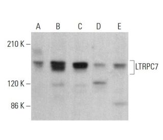 LTRPC7 Antibody (H-4) - Western Blotting - Image 383130 