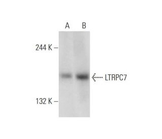 LTRPC7 Antibody (H-4) - Western Blotting - Image 129302The Double Nickase Plasmid features a U6 promoter for sgRNA expression, a 20 nt targeting sequence, and a gRNA scaffold to guide Cas9n. It includes a CBh promoter for Cas9n (D10A) and puromycin resistance, GFP for transfection verification, and nuclear localization signals (NLS). The 2A peptide allows co-expression of Cas9n and Puro from a single promoter, enabling precise genome editing with reduced off-target effects.