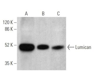 Lumican Antibody (B-9) - Western Blotting - Image 375140
