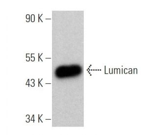 Lumican Antibody (B-9) - Western Blotting - Image 360154