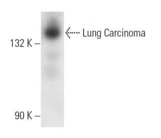 Lung Carcinoma Antibody (MOC-32) - Western Blotting - Image 12869