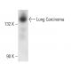 Lung Carcinoma Antibody (MOC-32) - Western Blotting - Image 12869