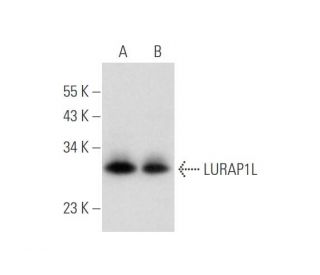 LURAP1L Antibody (E-4) - Western Blotting - Image 333679 