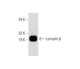 Lutropin &beta; Antibody (B-6) - Western Blotting - Image 294492 