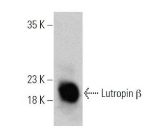 Lutropin β Antibody (B-6) | SCBT - Santa Cruz Biotechnology