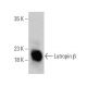 Lutropin β Antibody (B-6) - Western Blotting - Image 360635 