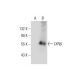 LXRα/β (G-10): sc-271064. Western blot analysis of LXRβ expression in non-transfected: sc-117752 (A) and human LXRβ transf
