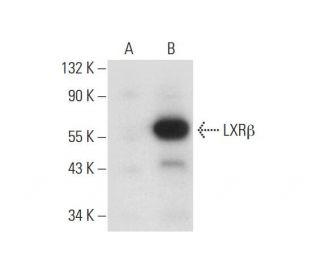 LXR&alpha;/&beta; (H-7): sc-377260. Western blot analysis of LXR&beta; expression in non-transfected: sc-117752 (A) and hu 