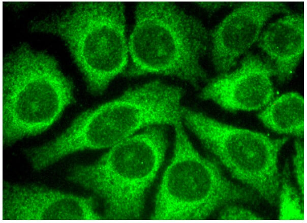 Ly-6K Antibody (G-11) | SCBT - Santa Cruz Biotechnology