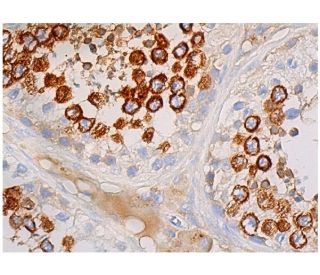 Ly-6K Antibody (G-11) | SCBT - Santa Cruz Biotechnology