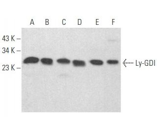 western blotting image from recommended Ly-GDI/RhoGDI2/ARHGDIB (G-12) monoclonal antibody replacement. Image 354460
