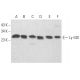 western blotting image from recommended Ly-GDI/RhoGDI2/ARHGDIB (G-12) monoclonal antibody replacement. Image 354460