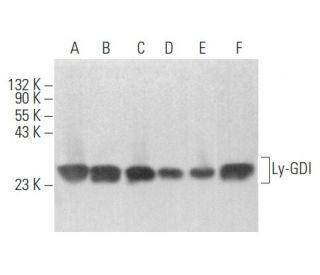 Ly-GDI/RhoGDI2/ARHGDIB Antibody (D-7) - Western Blotting - Image 354465 