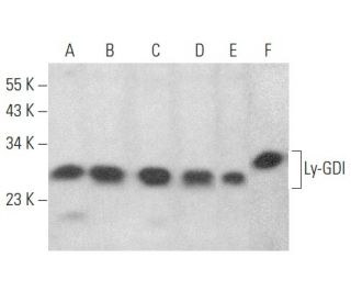 Ly-GDI/RhoGDI2/ARHGDIB Antibody (E-3) - Western Blotting - Image 354466 