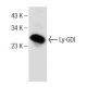 Ly-GDI/RhoGDI2/ARHGDIB Antibody (E-7) - Western Blotting - Image 151000