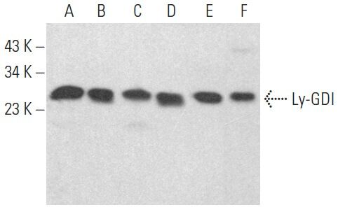 Anti Ly Gdi Rhogdi2 Arhgdib Antibody G 12 Scbt Santa Cruz Biotechnology