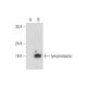 lymphotactin Antibody (E-12) - Western Blotting - Image 333653 