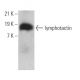 lymphotactin Antibody (E-12) - Western Blotting - Image 366258