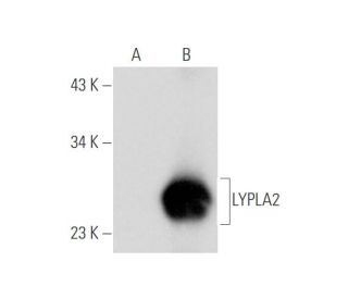 LYPLA2 Antibody (B-11) - Western Blotting - Image 333804 