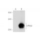 LYPLA2 Antibody (B-11) - Western Blotting - Image 333804 
