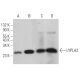 LYPLA2 Antibody (B-11) - Western Blotting - Image 366588 