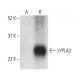 LYPLA2 Antibody (B-11) - Western Blotting - Image 398519