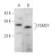 LYSMD1 Antibody (G-11) - Western Blotting - Image 368977