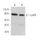 LysRS Antibody (D-4) - Western Blotting - Image 371684