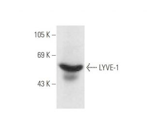 LYVE-1 Antibody (E9VA4) - Western Blotting - Image 62646SAM Transcription Activation: SAM system utilizing dCas9-VP64, MS2-P65-HSF1, and sgRNA for precise gene transcription activation.