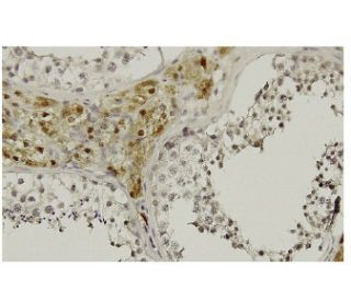LZIP Antibody (Q-61) - Immunohistochemistry - Image 36246 
