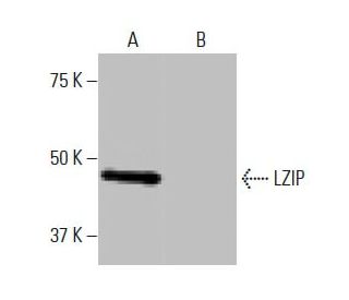LZIP Antibody (Q-61) - Western Blotting - Image 67393Each CRISPR/Cas9 Knockout (KO) Plasmid product consists of a pool of 3 plasmids designed to ensure identification and cleavage of a specific gene for maximum knockout efficiency. Each plasmid encodes a unique 20 nt sequence derived from the GeCKO (v2) library.
