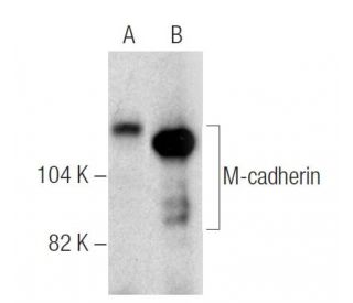 M-cadherin Antibody (12G4) - Western Blotting - Image 281645 