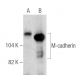 M-cadherin Antibody (12G4) - Western Blotting - Image 281645 