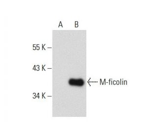 M-ficolin Antibody (036-05-1) - Western Blotting - Image 57388