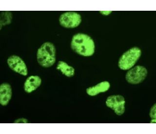 p54/nrb Antibody (F-5): sc-376804. Immunofluorescence staining of formalin-fixed HeLa cells showing nuclear localization. 