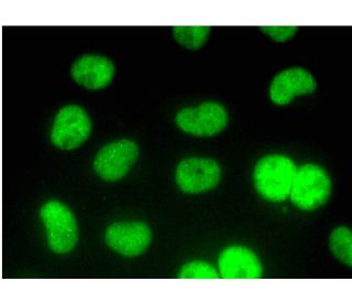 EWS (C-9): sc-48404. Immunofluorescence detection of EWS in formalin-fixed HeLa cells showing nuclear localization. Detect 