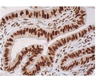 m-IgGκ BP-HRP | SCBT - Santa Cruz Biotechnology