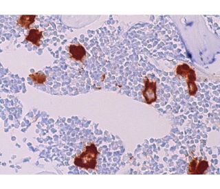 Anti-Alpha-synuclein (phospho S129) antibody [MJF-R13 (8-8)] (ab168381) |  Abcam
