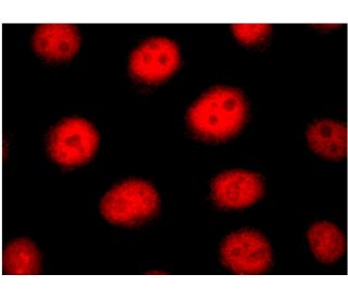 Ku-86 (B-1): sc-5280. Immunofluorescence detection of Ku-86 staining of formalin-fixed HeLa cells showing nuclear localiza 