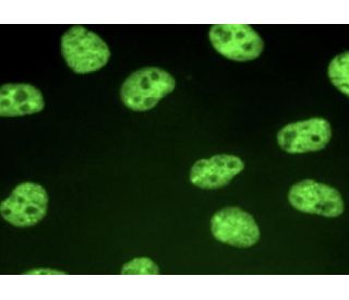 p54/nrb Antibody (F-5): sc-376804. Immunofluorescence staining of formalin-fixed HeLa cells showing nuclear localization. 