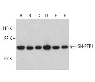 SH-PTP1 (D-11): sc-7289. Western blot analysis of SH-PTP1 expression in HEL 92.1.7 (A), TF-1 (B), CCRF-CEM (C), HL-60 (D), 