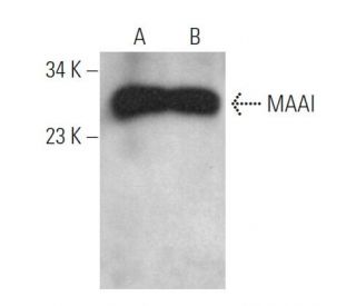 MAAI Antibody (H-4) - Western Blotting - Image 368962 