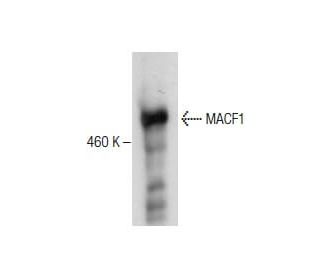 MACF1 Antibody (H-12) - Western Blotting - Image 281136