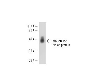 western blotting image from recommended mAChR M2 (M2-2-B3) monoclonal antibody replacement. Image 11699