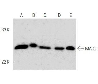 western blotting image from recommended MAD2 (C-10) monoclonal antibody replacement. Image 358462