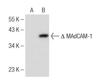 MAdCAM-1 Antibody (F-6) - Western Blotting - Image 150295 