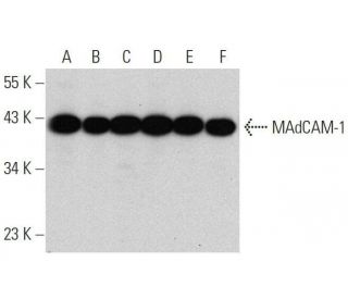 MAdCAM-1 Antibody (H-3) - Western Blotting - Image 359415 
