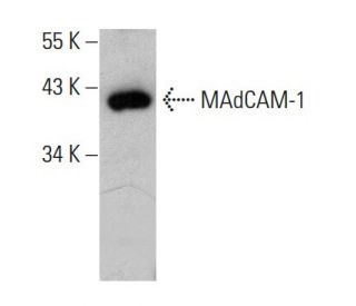 madcam@プロフィール必須 MAdCAM-1抗体(H-3) | SCBT - Santa Cruz Biotechnology