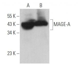 MAGE-A Antibody (6C1) - Western Blotting - Image 361902 